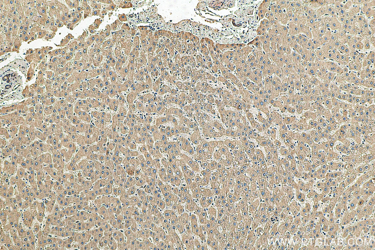 Immunohistochemistry (IHC) staining of human liver tissue using Apolipoprotein CIII Polyclonal antibody (22262-1-AP)