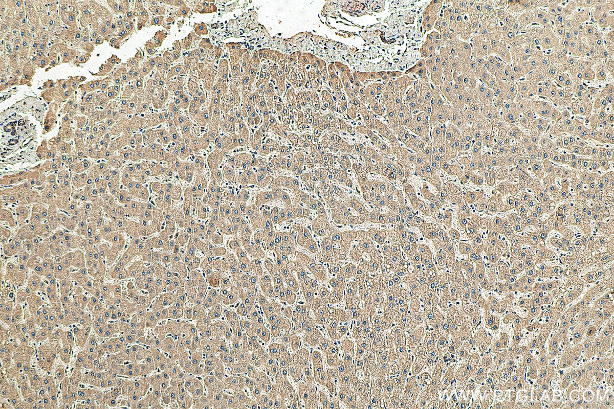 Immunohistochemistry (IHC) staining of human liver tissue using APOC3 Polyclonal antibody (22262-1-AP)