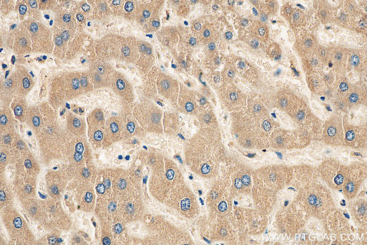 Immunohistochemistry (IHC) staining of human liver tissue using APOC3 Polyclonal antibody (22262-1-AP)