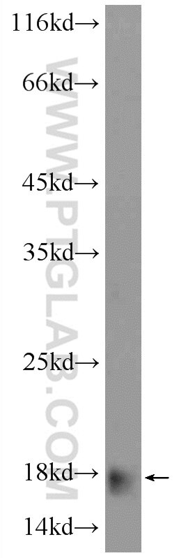 WB analysis of human plasma using 16530-1-AP