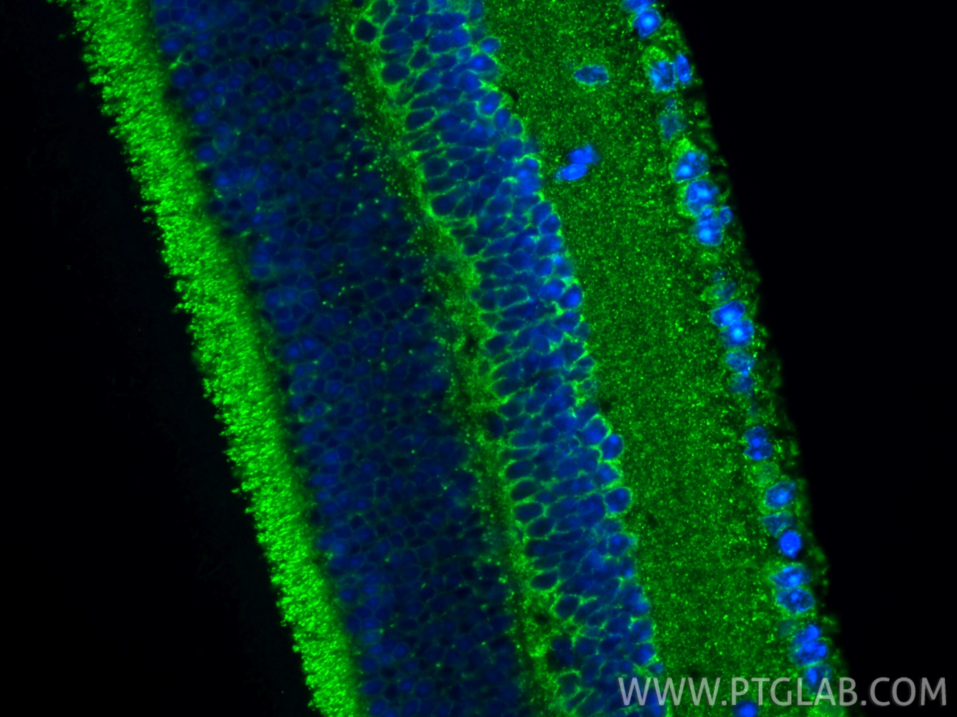 Immunofluorescence (IF) / fluorescent staining of mouse eye tissue using APOD Polyclonal antibody (10520-1-AP)