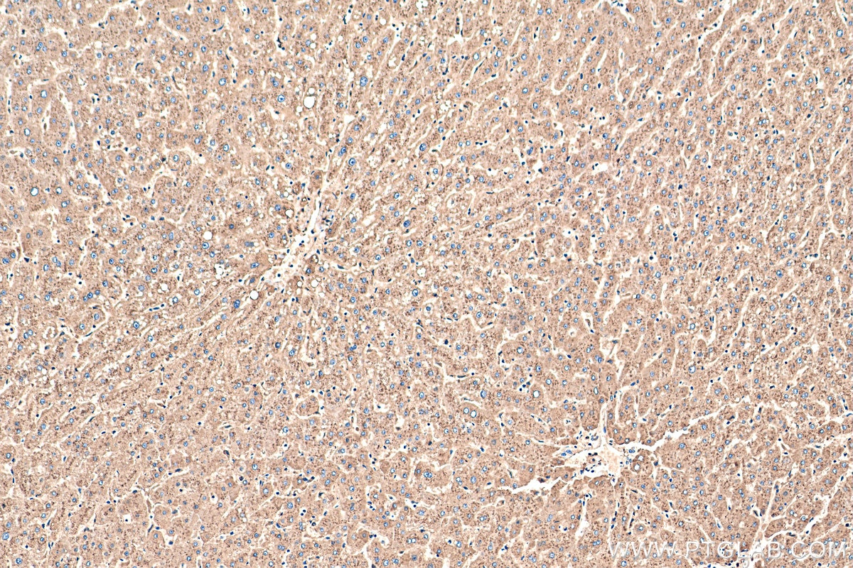 Immunohistochemistry (IHC) staining of human liver tissue using APOD Polyclonal antibody (10520-1-AP)