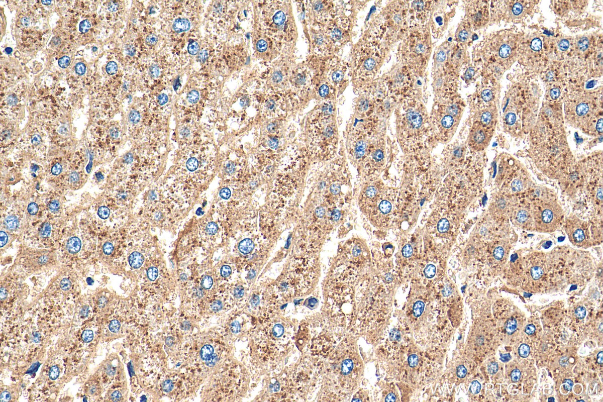 Immunohistochemistry (IHC) staining of human liver tissue using APOD Polyclonal antibody (10520-1-AP)