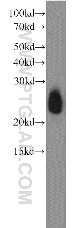 Western Blot (WB) analysis of human plasma using APOD Polyclonal antibody (10520-1-AP)