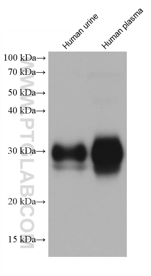 Western Blot (WB) analysis of various lysates using APOD Monoclonal antibody (66215-1-Ig)