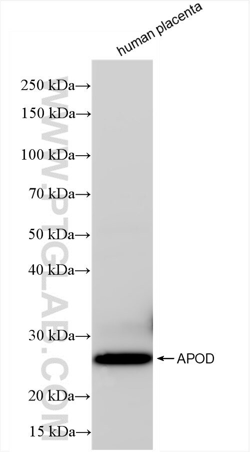 Western Blot (WB) analysis of human placenta tissue using APOD Recombinant antibody (86500-1-RR)