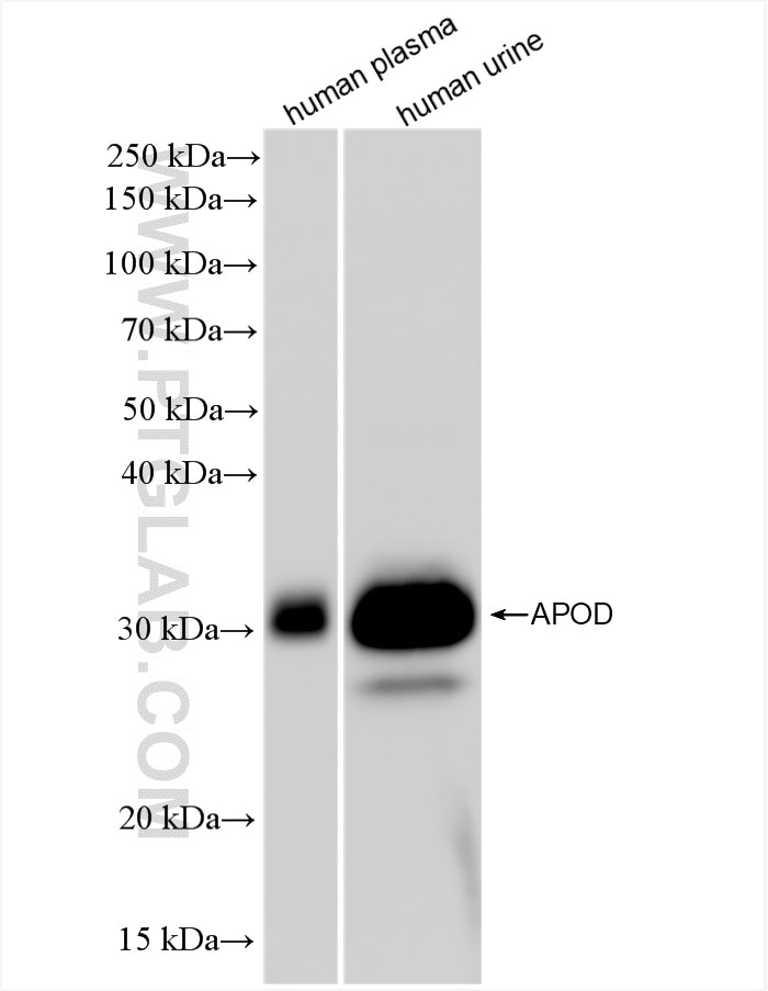 Western Blot (WB) analysis of various lysates using APOD Recombinant antibody (86500-1-RR)