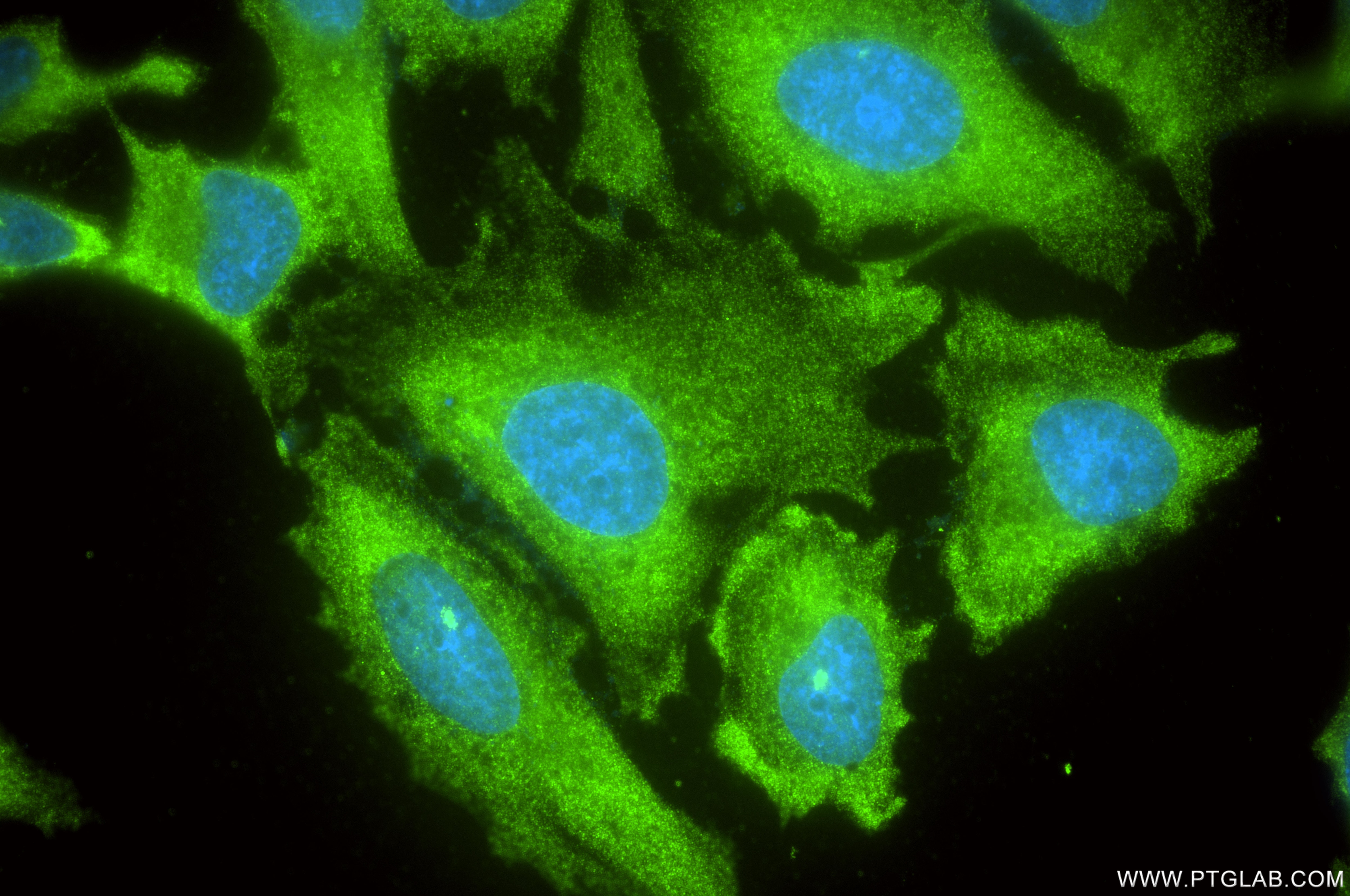 Immunofluorescence (IF) / fluorescent staining of HeLa cells using APOD Recombinant monoclonal antibody (86500-2-RR)