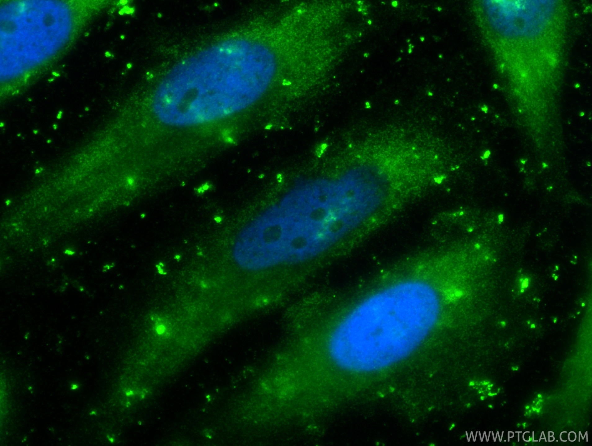 IF Staining of HeLa using 86500-2-RR Immunofluorescence (IF) / fluorescent staining of HeLa cells using APOD Recombinant monoclonal antibody (86500-2-RR)