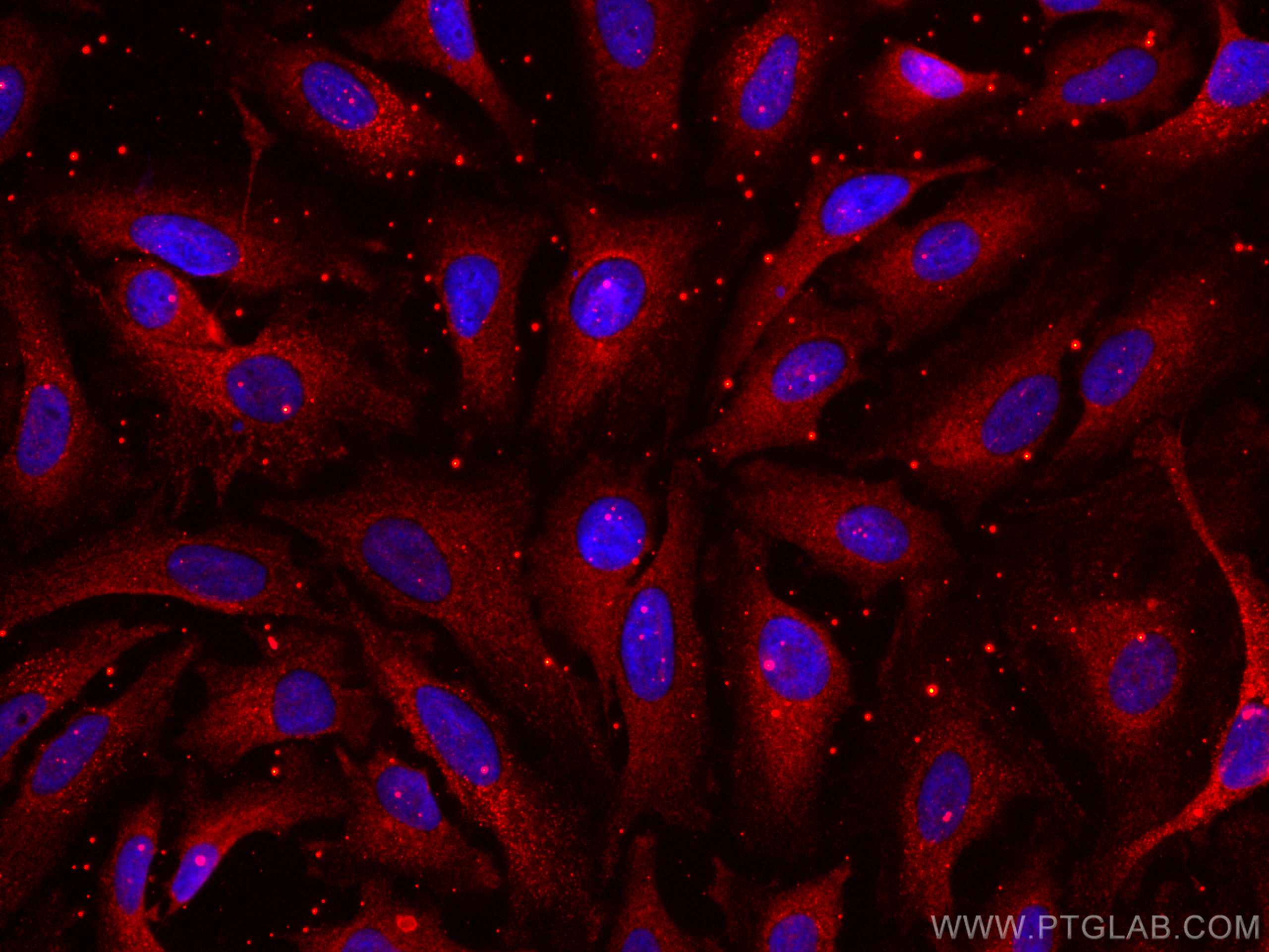 IF Staining of HeLa using CL594-66215