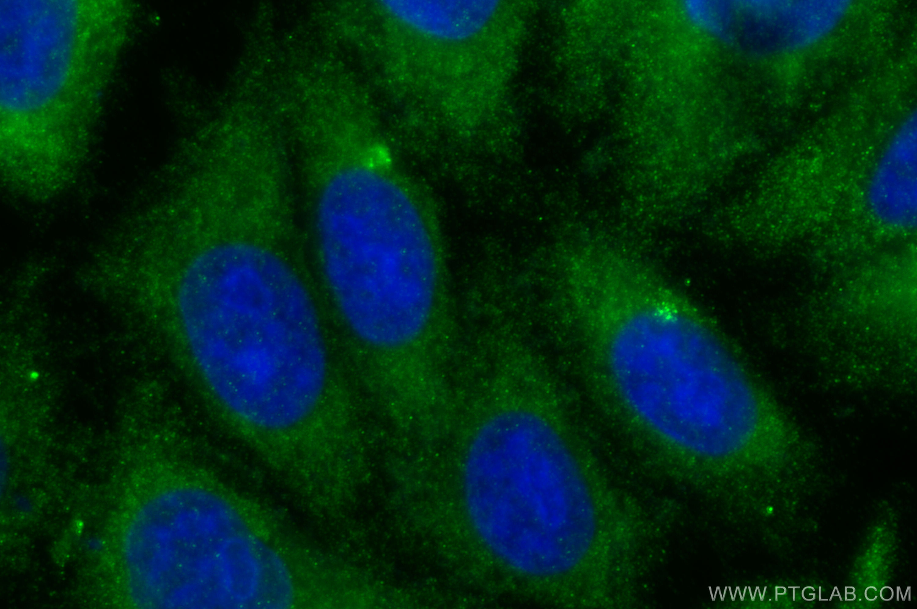 Immunofluorescence (IF) / fluorescent staining of HepG2 cells using APOE Polyclonal antibody (18254-1-AP)