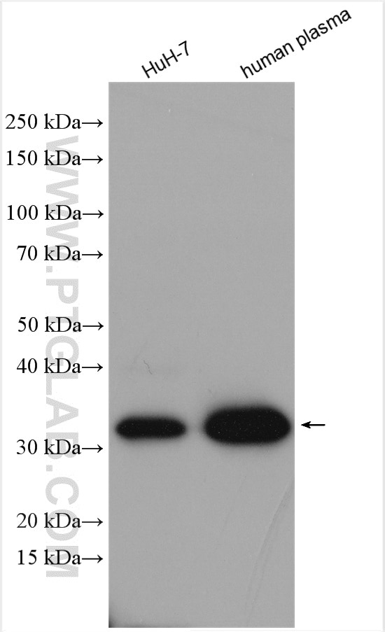 Western Blot (WB) analysis of various lysates using APOE Polyclonal antibody (18254-1-AP)