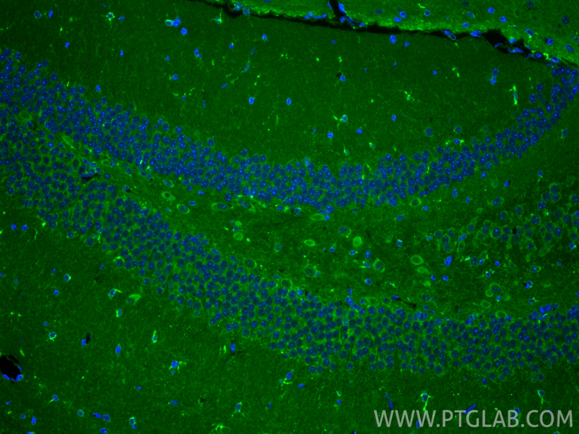 IF Staining of mouse brain using CL488-31454 Immunofluorescence (IF) / fluorescent staining of mouse brain tissue using CoraLite® Plus 488-conjugated APOE Polyclonal anti (CL488-31454)