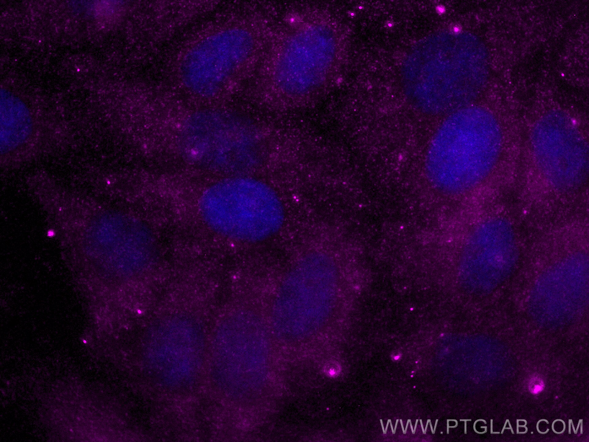 Immunofluorescence (IF) / fluorescent staining of HepG2 cells using CoraLite® Plus 647-conjugated APOE Recombinant ant (CL647-84775-7)