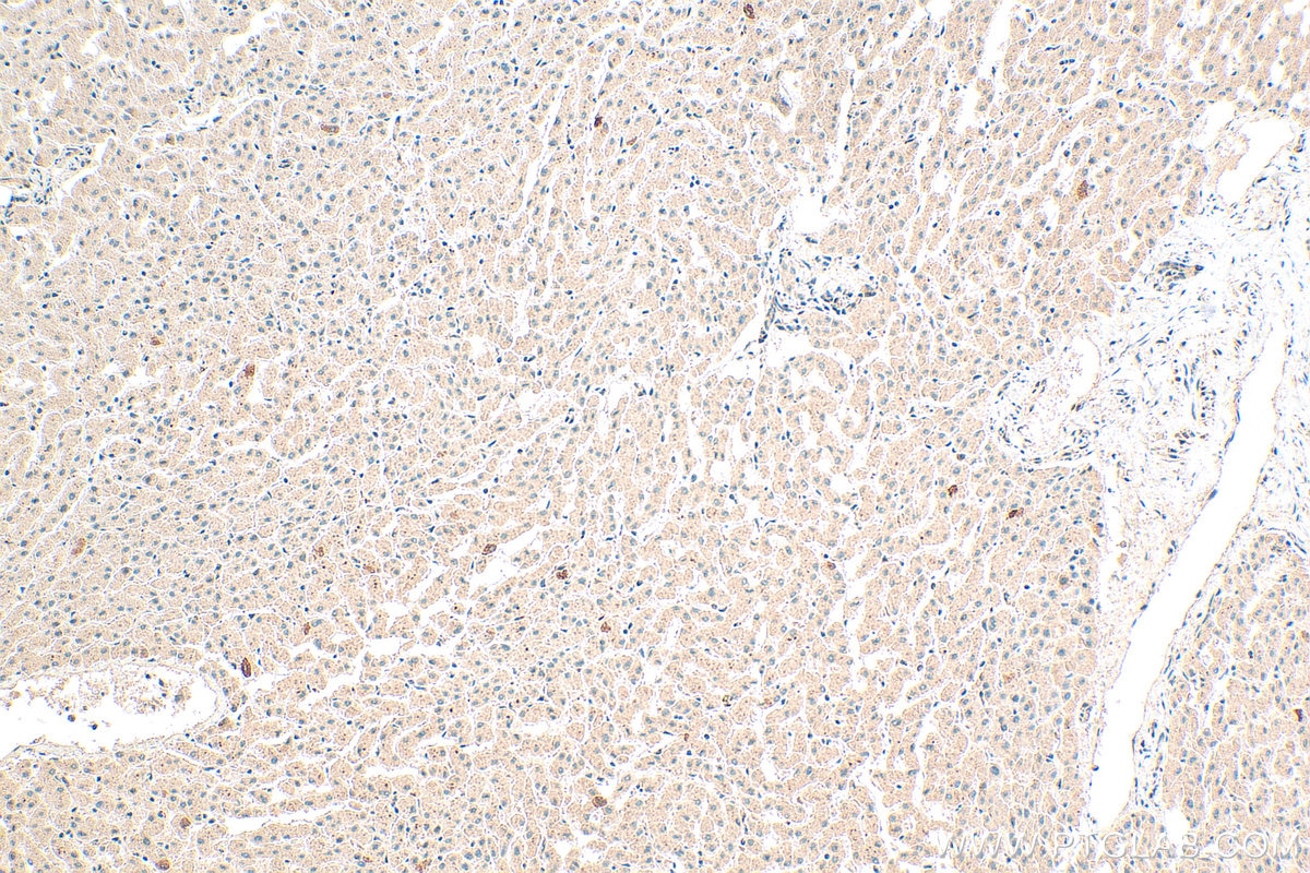 Immunohistochemistry (IHC) staining of human liver tissue using APOF Polyclonal antibody (16608-1-AP)