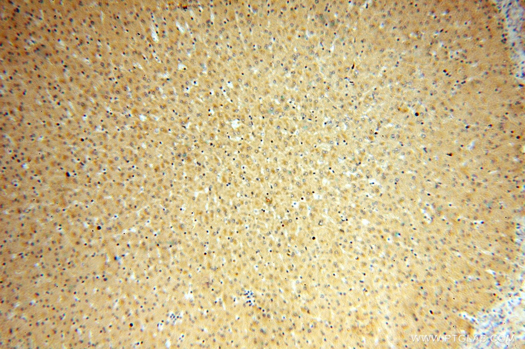 Immunohistochemistry (IHC) staining of human liver tissue using APOF Polyclonal antibody (16608-1-AP)