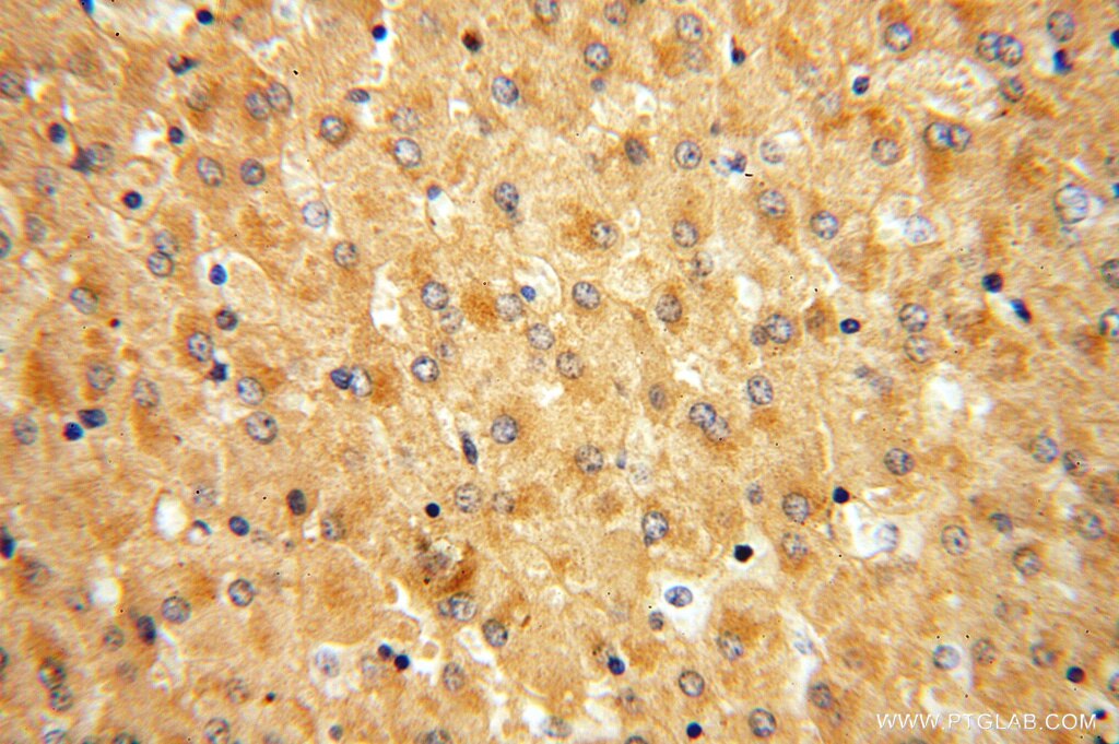 Immunohistochemistry (IHC) staining of human liver tissue using APOF Polyclonal antibody (16608-1-AP)