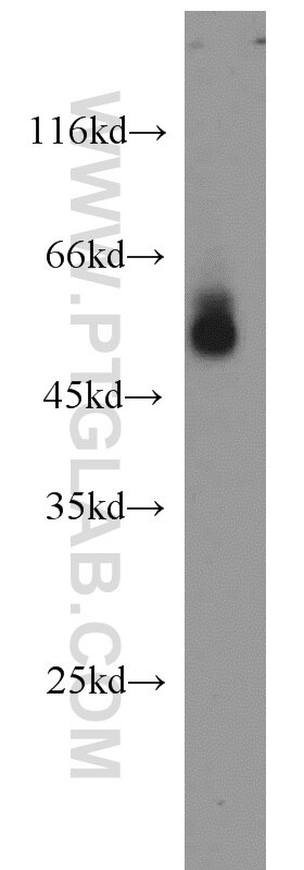 Western Blot (WB) analysis of human plasma using Apolipoprotein H Polyclonal antibody (11892-1-AP)