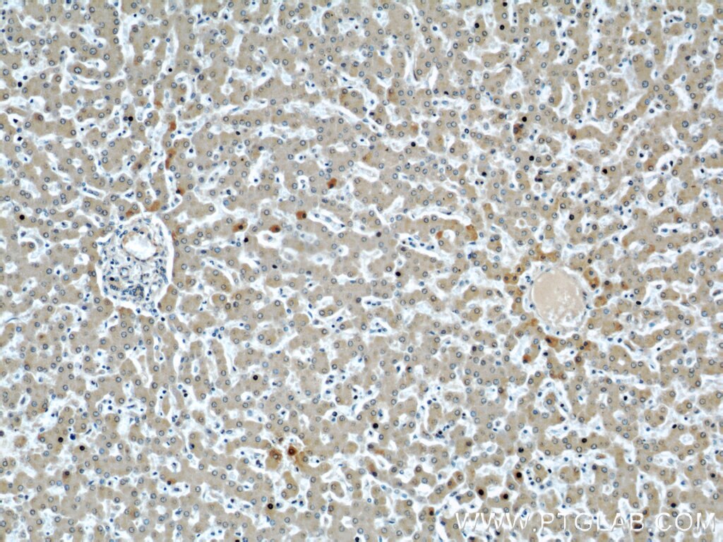 Immunohistochemistry (IHC) staining of human liver tissue using Apolipoprotein H Monoclonal antibody (66074-1-Ig)