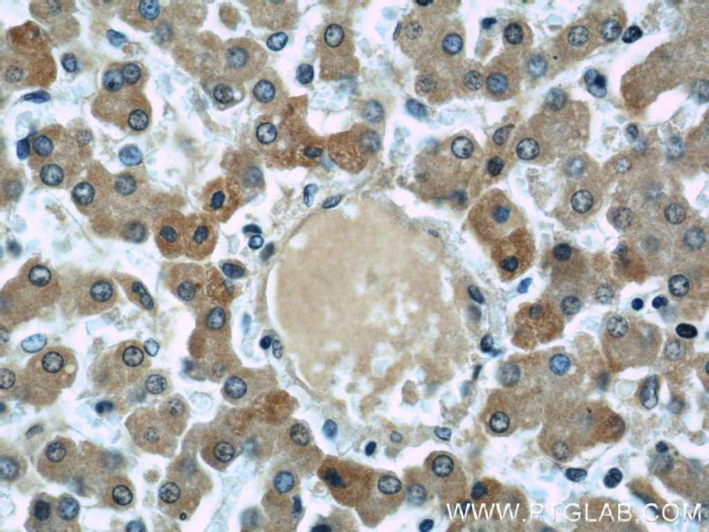 Immunohistochemistry (IHC) staining of human liver tissue using Apolipoprotein H Monoclonal antibody (66074-1-Ig)