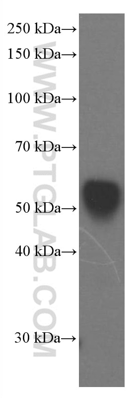 Western Blot (WB) analysis of human plasma using Apolipoprotein H Monoclonal antibody (66074-1-Ig)