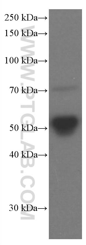 WB analysis of pig plasma using 66074-1-Ig