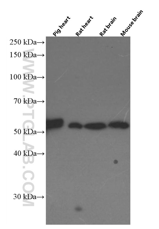 Western Blot (WB) analysis of various lysates using Apolipoprotein H Monoclonal antibody (66074-1-Ig)