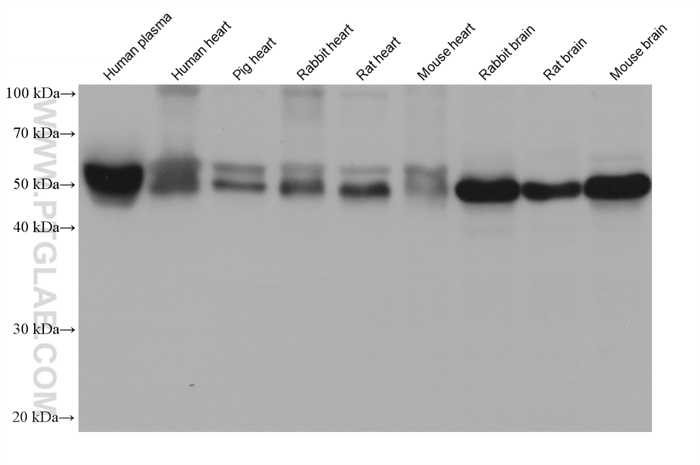 Western Blot (WB) analysis of various lysates using Apolipoprotein H Monoclonal antibody (66074-1-Ig)