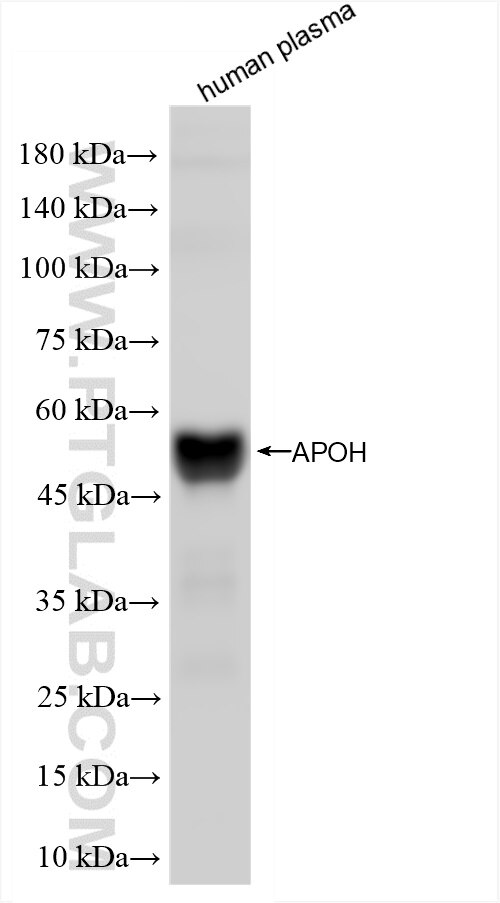 Western Blot (WB) analysis of human plasma using APOH Recombinant antibody (84943-2-RR)