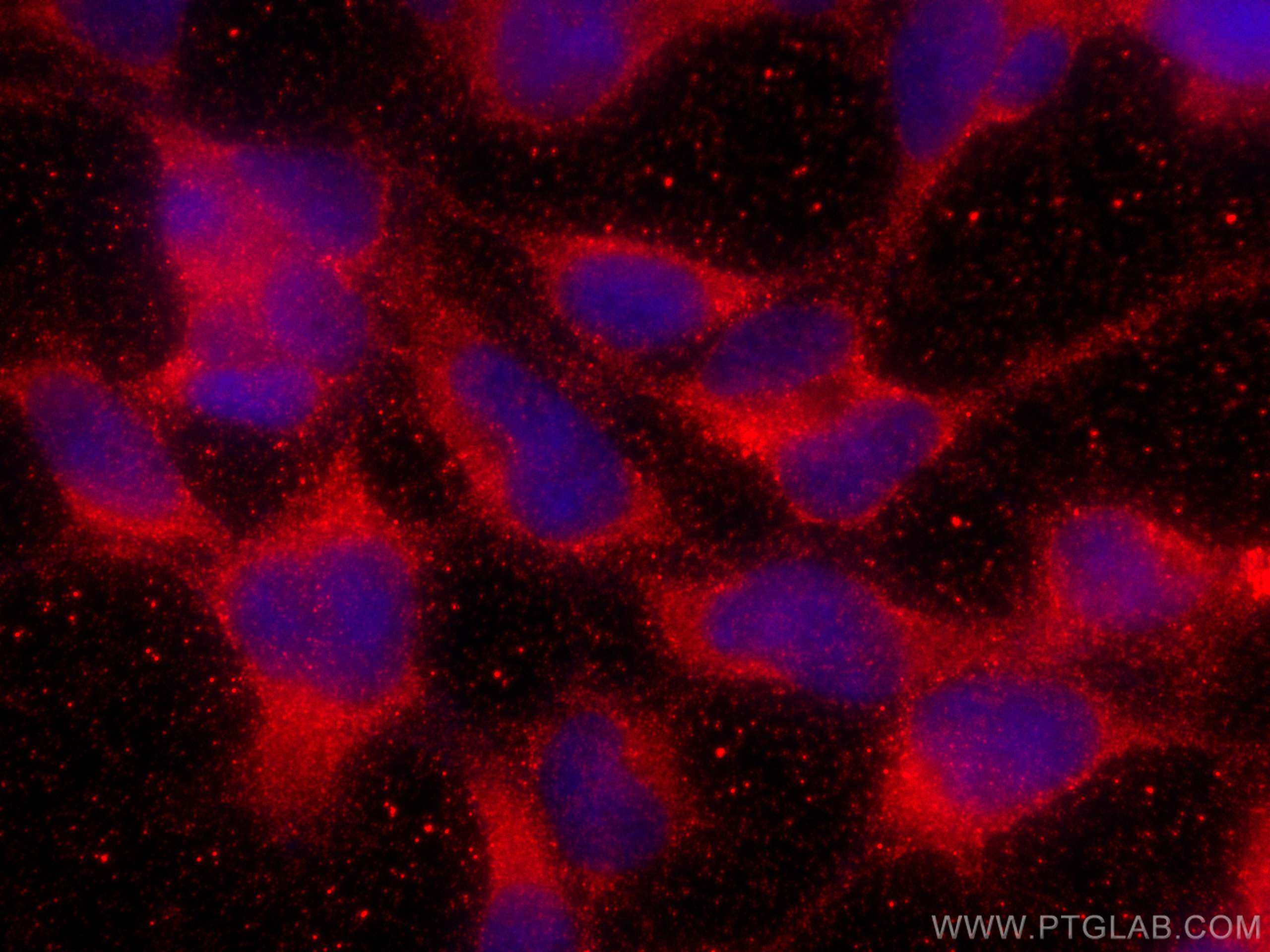 Immunofluorescence (IF) / fluorescent staining of HEK-293 cells using APOL1 Polyclonal antibody (11486-2-AP)