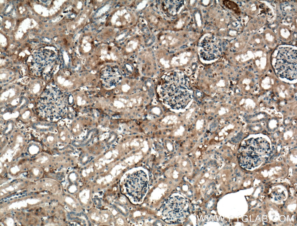 Immunohistochemistry (IHC) staining of human kidney tissue using APOL1 Polyclonal antibody (11486-2-AP)