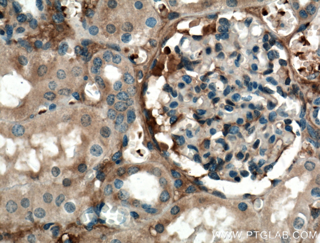 Immunohistochemistry (IHC) staining of human kidney tissue using APOL1 Polyclonal antibody (11486-2-AP)