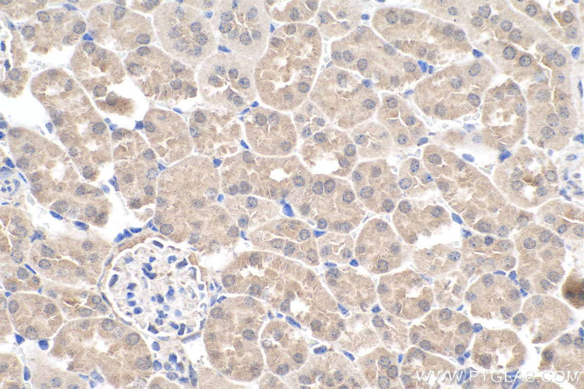 Immunohistochemistry (IHC) staining of mouse kidney tissue using APOL1 Polyclonal antibody (11486-2-AP)