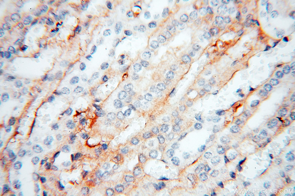Immunohistochemistry (IHC) staining of human kidney tissue using APOL1 Polyclonal antibody (11486-2-AP)