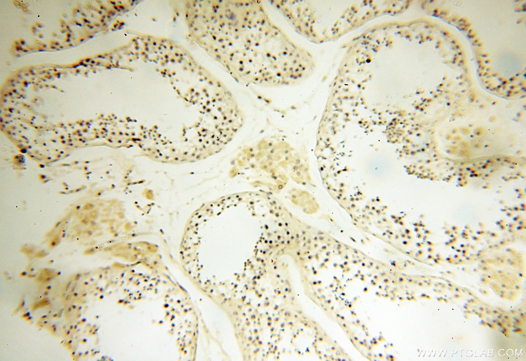 Immunohistochemistry (IHC) staining of human testis tissue using APOL1 Polyclonal antibody (11486-2-AP)