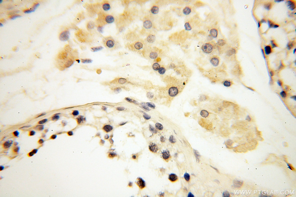 Immunohistochemistry (IHC) staining of human testis tissue using APOL1 Polyclonal antibody (11486-2-AP)