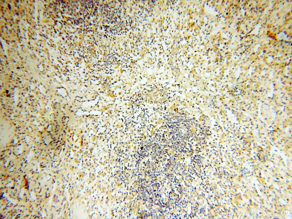 Immunohistochemistry (IHC) staining of human spleen tissue using APOL1 Polyclonal antibody (11486-2-AP)