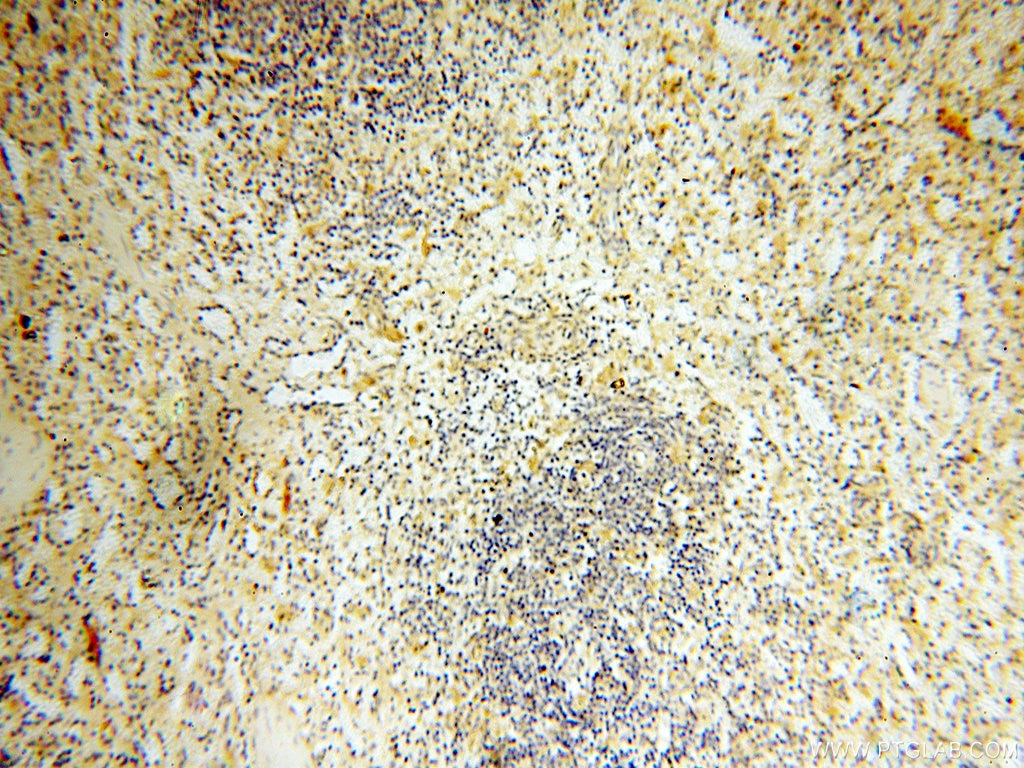 Immunohistochemistry (IHC) staining of human spleen tissue using APOL1 Polyclonal antibody (11486-2-AP)