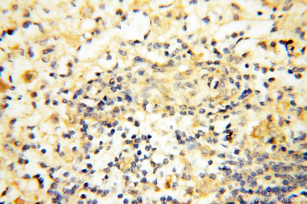 Immunohistochemistry (IHC) staining of human spleen tissue using APOL1 Polyclonal antibody (11486-2-AP)