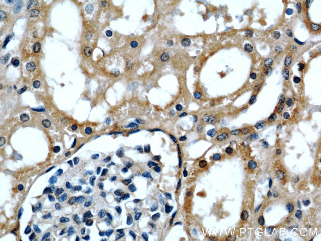 Immunohistochemistry (IHC) staining of human kidney tissue using APOL1 Polyclonal antibody (11486-2-AP)