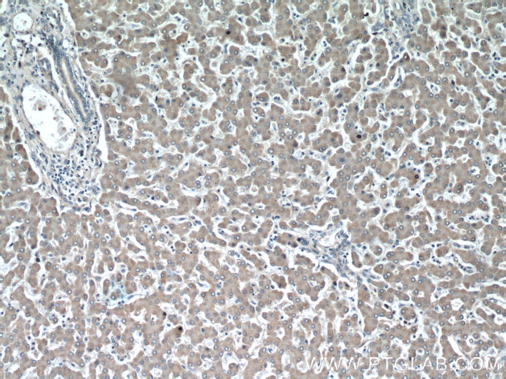 Immunohistochemistry (IHC) staining of human liver tissue using APOL1 Polyclonal antibody (11486-2-AP)