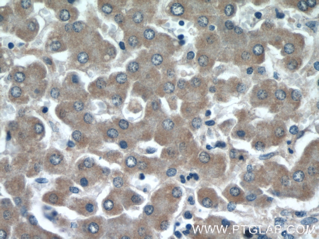 IHC staining of human liver using 11486-2-AP