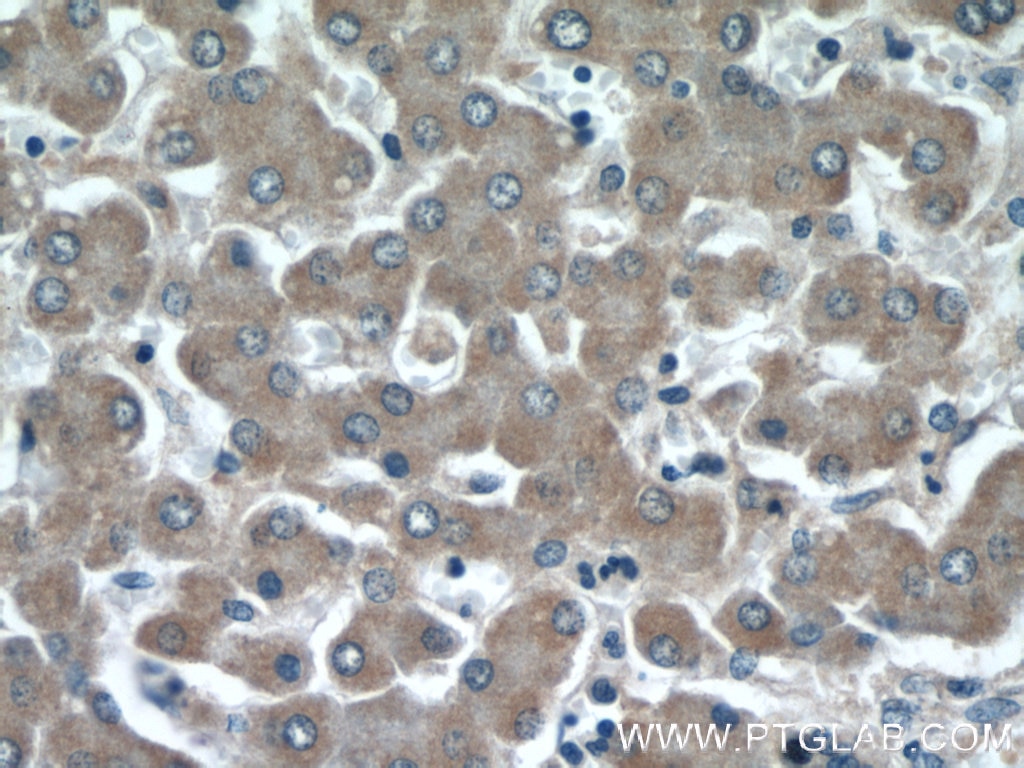 Immunohistochemistry (IHC) staining of human liver tissue using APOL1 Polyclonal antibody (11486-2-AP)