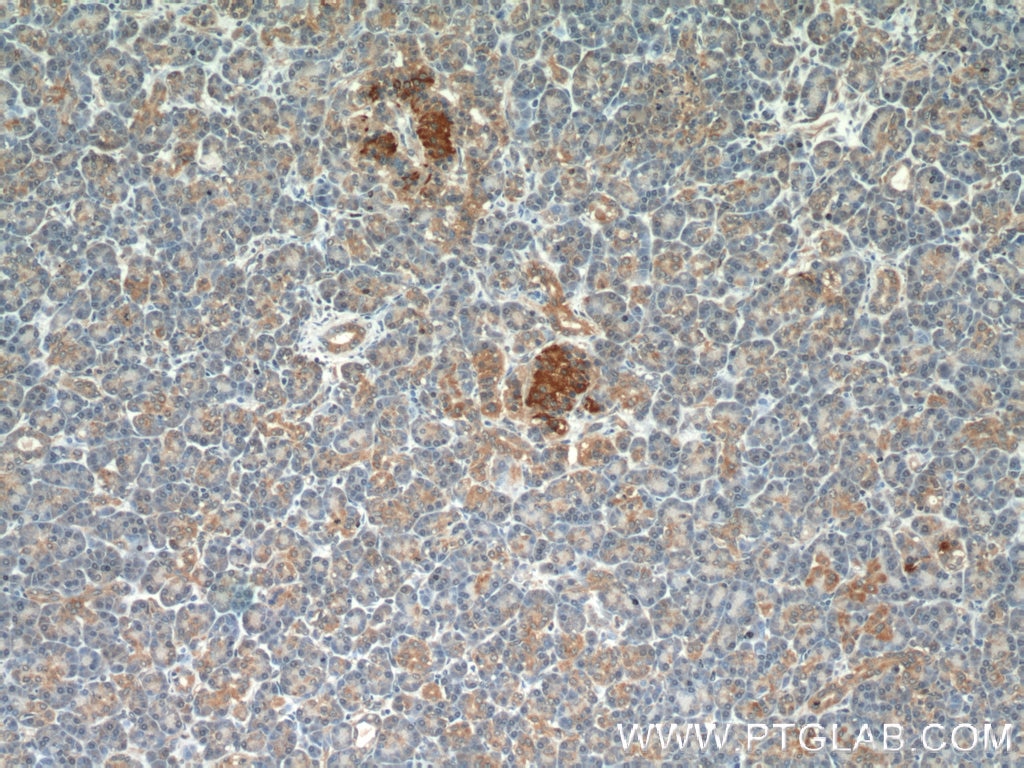 Immunohistochemistry (IHC) staining of human pancreas tissue using APOL1 Polyclonal antibody (11486-2-AP)