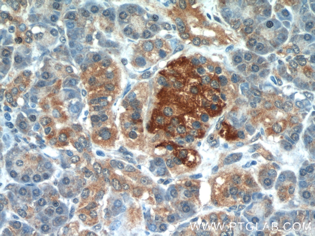 Immunohistochemistry (IHC) staining of human pancreas tissue using APOL1 Polyclonal antibody (11486-2-AP)