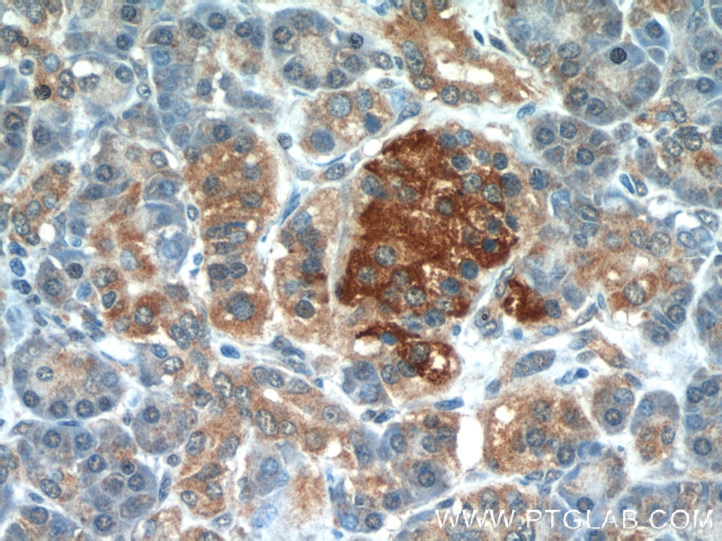 IHC staining of human pancreas using 11486-2-AP