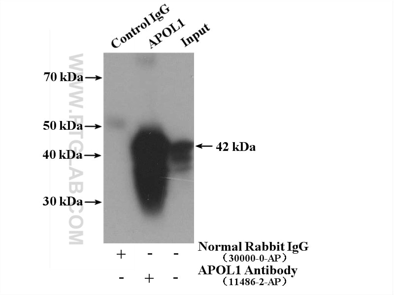 Immunoprecipitation (IP) experiment of human plasma using APOL1 Polyclonal antibody (11486-2-AP)