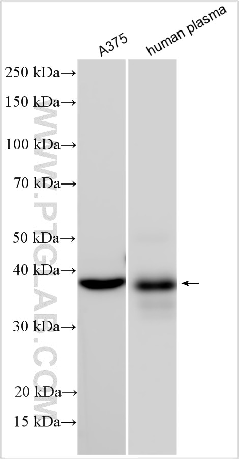 Western Blot (WB) analysis of various lysates using APOL1 Polyclonal antibody (11486-2-AP)