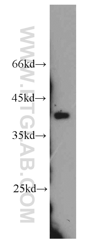 Western Blot (WB) analysis of A549 cells using APOL1 Polyclonal antibody (11486-2-AP)