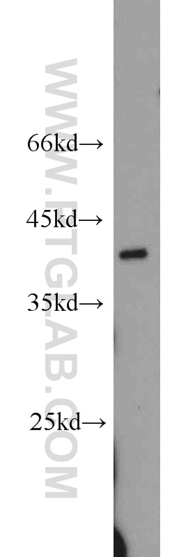 Western Blot (WB) analysis of SKOV-3 cells using APOL1 Polyclonal antibody (11486-2-AP)